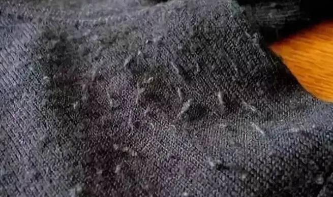 清除衣服上毛屑的簡單方法有哪些？