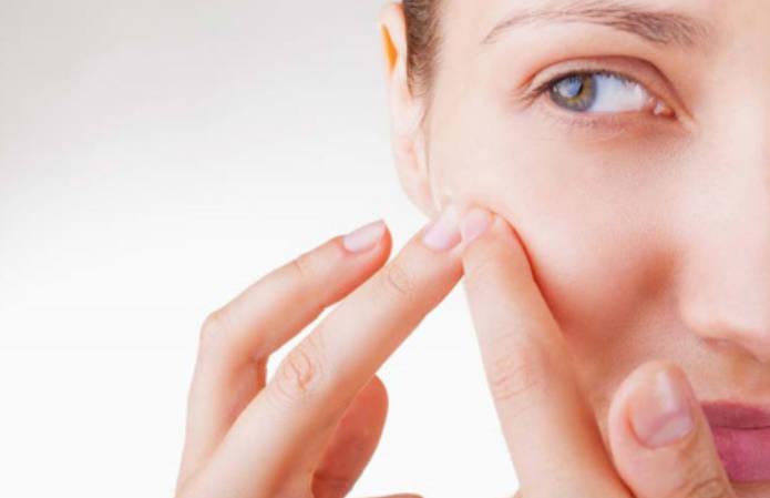 想消除痘痘，涂牙膏或貼止痛膏有作用嗎？