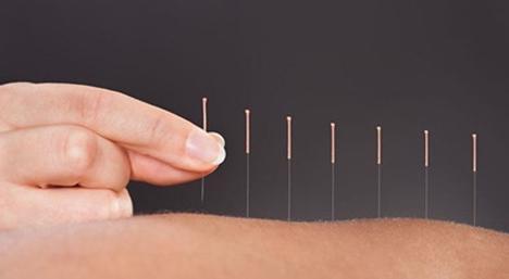 平衡針灸治療頸椎病效果怎么樣？