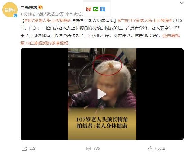 107歲老人頭上長壽角，身體健康引網友關注