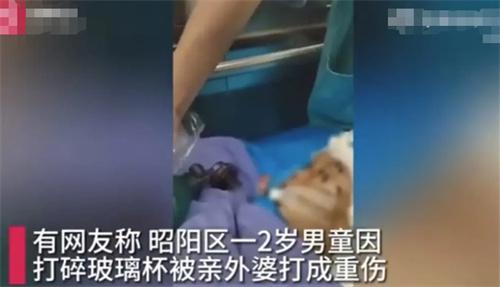 2歲男童因打碎玻璃杯遭外婆暴力毆打，生命岌岌可危