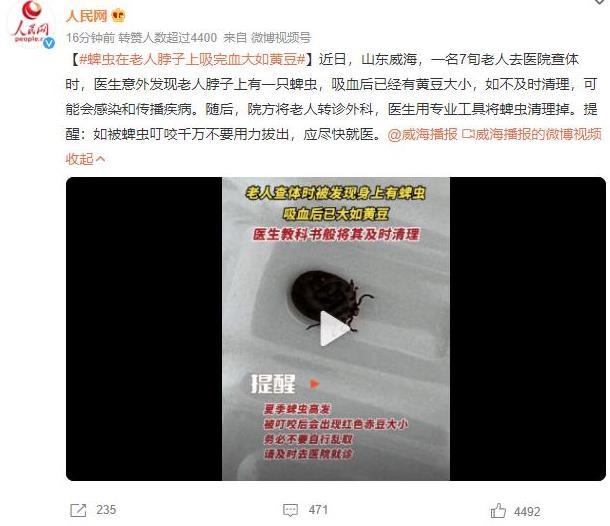 山東威海發現老人脖子上蜱蟲，及時清理避免疾病傳播，掌握蜱蟲清理與預防方法