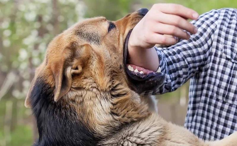 狗咬傷女子臉部，500多針縫合：溫州醫生的英勇搶救之路