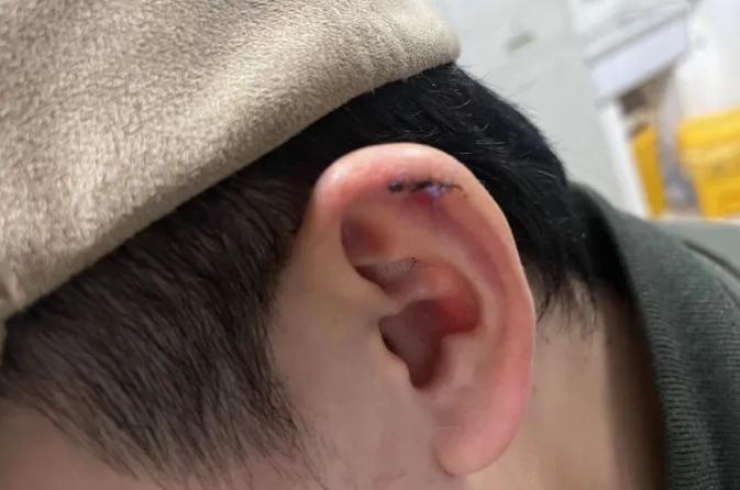 不幸造型經歷引發的理發行業賠償風波