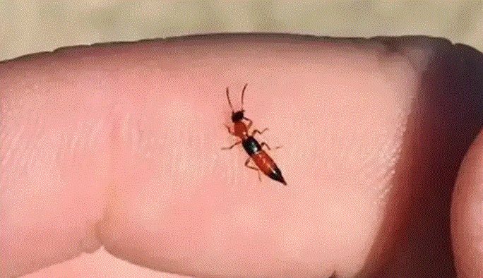 小心！隱翅蟲“襲擊”，應對措施別錯過！